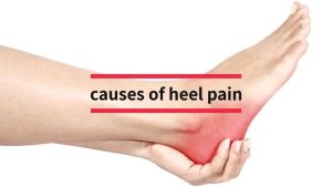 Plantar Fasciitis and Heel Pain (The Often Overlooked Cause) By Dr. Jack Herbert